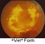 retina_specialist_in_thane