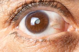 cataract_surgery_thane