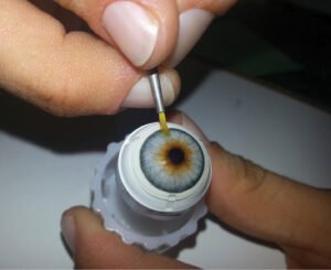 Artificial Eye Prosthetics