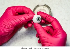 Artificial Eye Prosthetics