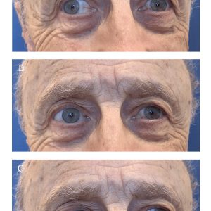 article_river_b467d2b052d811ed971fabc9d2f1fd2b-Figure-1 article_river_b467d2b052d811ed971fabc9d2f1fd2b-Figure-1