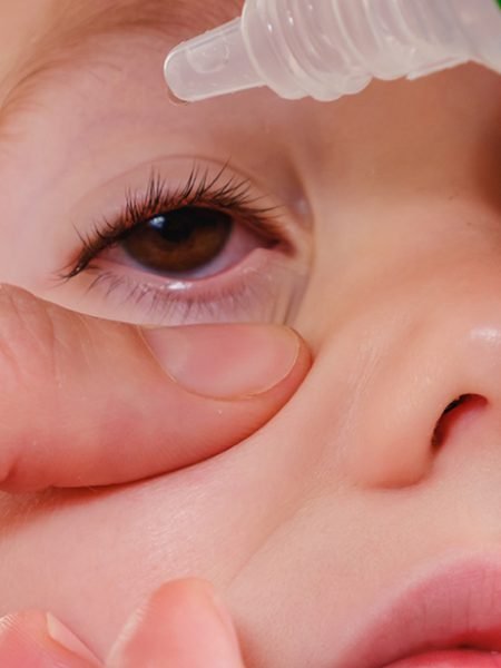 Eye child allergy and conjunctivitis infection red allergic,  medicine.