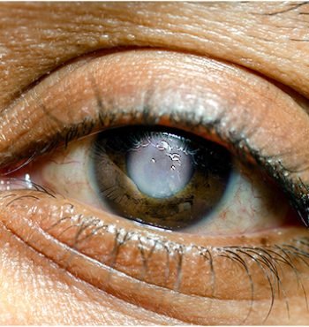 best_ocular_trauma_doctors_in_kalyan