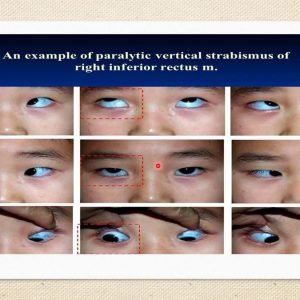 fe3fec84a51cb75eefeca4e663b19258 fe3fec84a51cb75eefeca4e663b19258